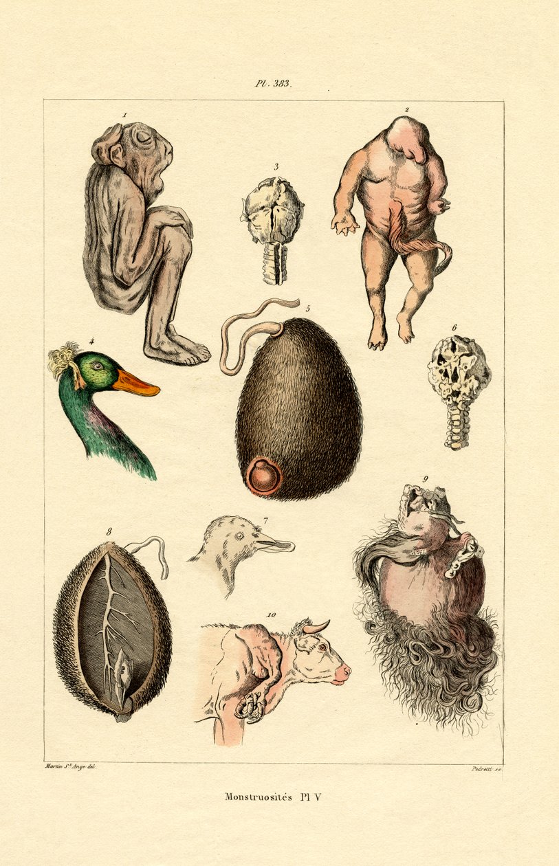 Anormal, 1833-39 de French School