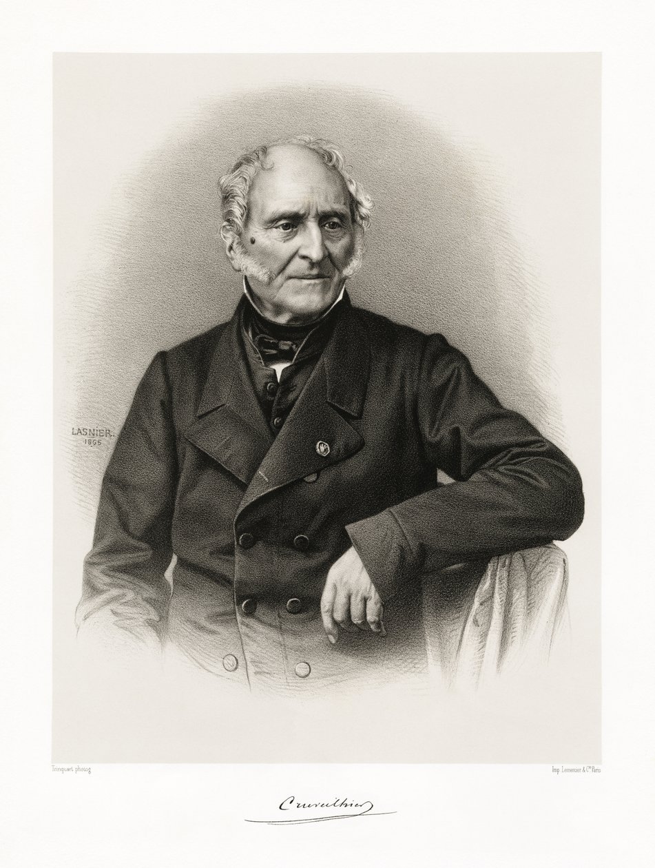 Jean Cruveilhier, 1865-66 de Lasnier