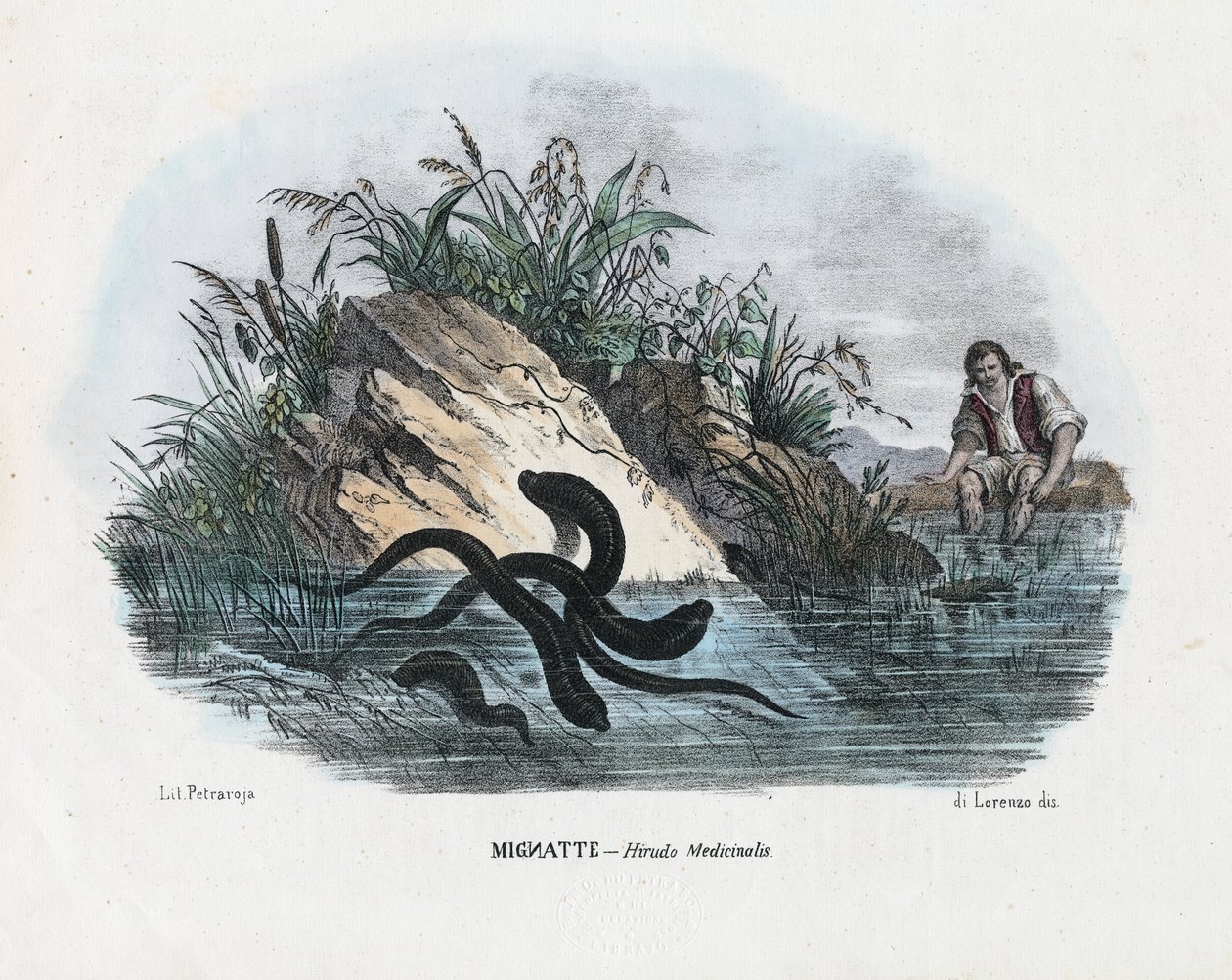 Sanguessugas, 1863-79 de Raimundo Petraroja