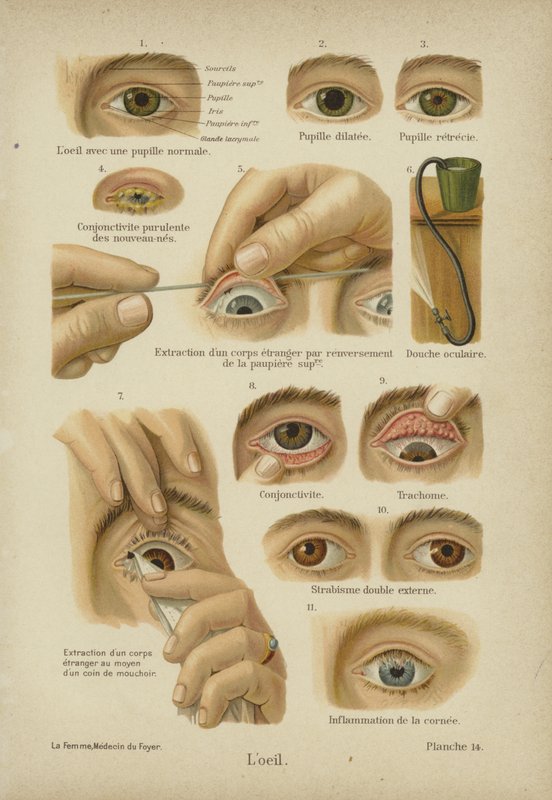O olho (cor litho) de German School